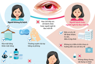 Các biện pháp phòng chống bệnh đau mắt đỏ